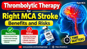 Thrombolytic Therapy for Right MCA Stroke: Benefits and Risks