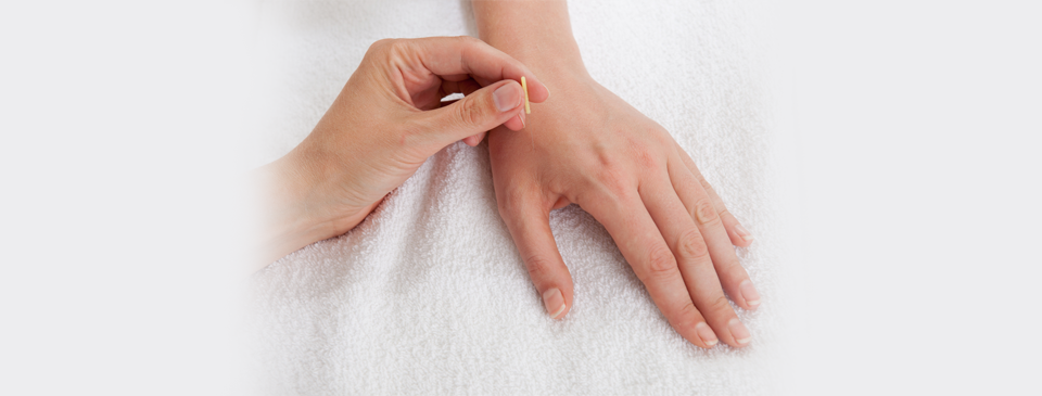 Acupuncture