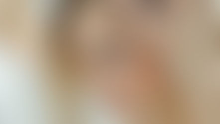 Эффективное лечение алопеции в клинике Казахстана