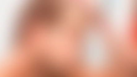 Проявления алопеции у мужчин и женщин