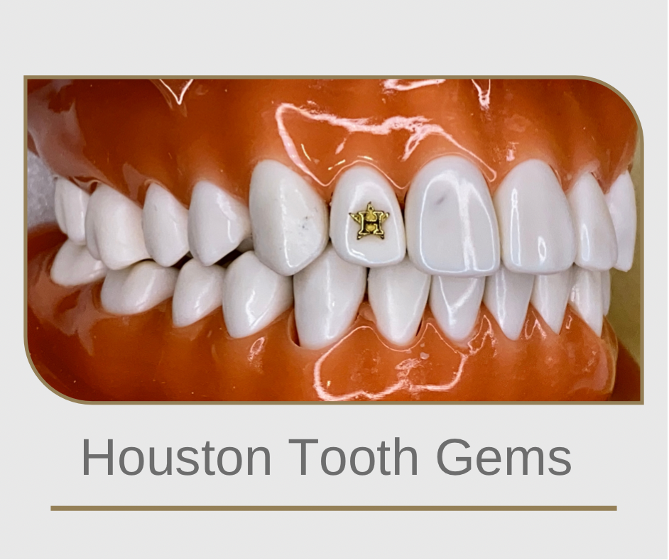 22K yellow gold  Houston Astros themed tooth gem