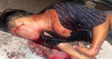 Joven es apuñal4d0 a manos de su hermano mayor en la Smza. 76 de Cancún