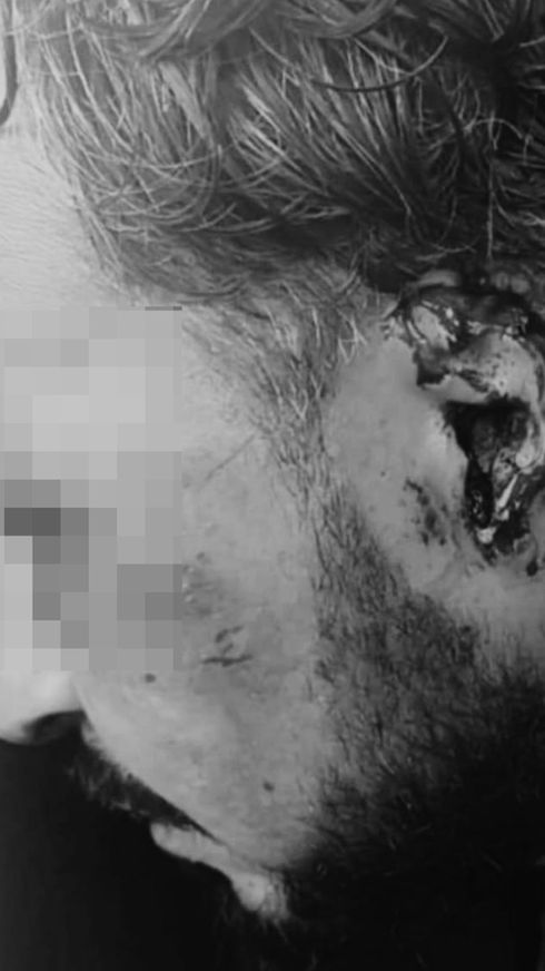 Turista colombiano secuestrado en Cancún y abandonado con lesiones en Bonfil