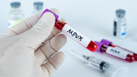 OMS rebautiza a la viruela del mono como “mpox” para evitar estigmatizaciones