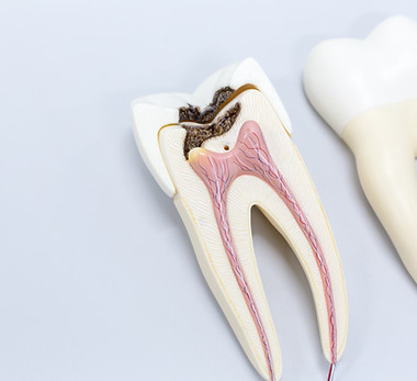  Tooth model for classroom education and in laboratory