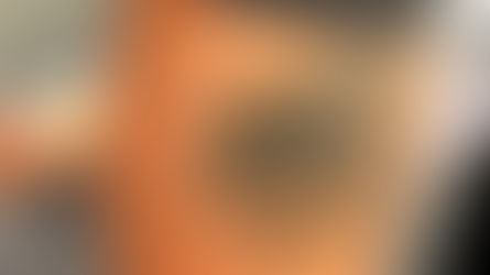 Tiny Tattoo Removals