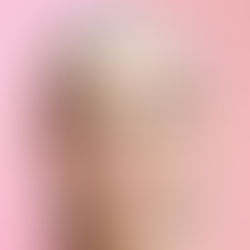 Getting Fillers and Botox? A Comprehensive Guide