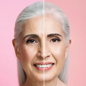 Getting Fillers and Botox? A Comprehensive Guide