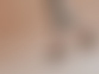 O impacto do uso prolongado de salto alto na saúde dos joelhos