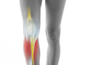 Como prevenir a inflamação nos tendões do joelho com alongamentos e cuidados?