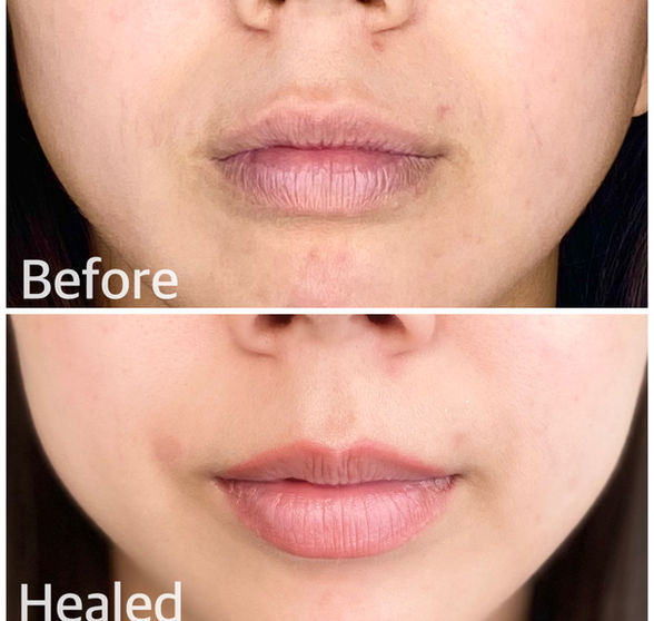 lip definition La Jolla