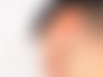 بەرکەوتن و برینداری سەر