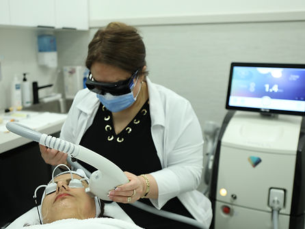 IPL Rosacea & Vascular Lesions Treatment