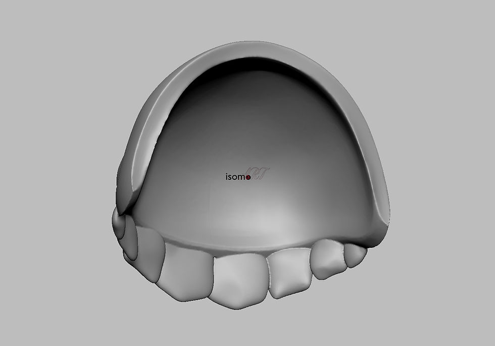Thumbnail: Hades Shoulder Pauldron - Hades 3DModel