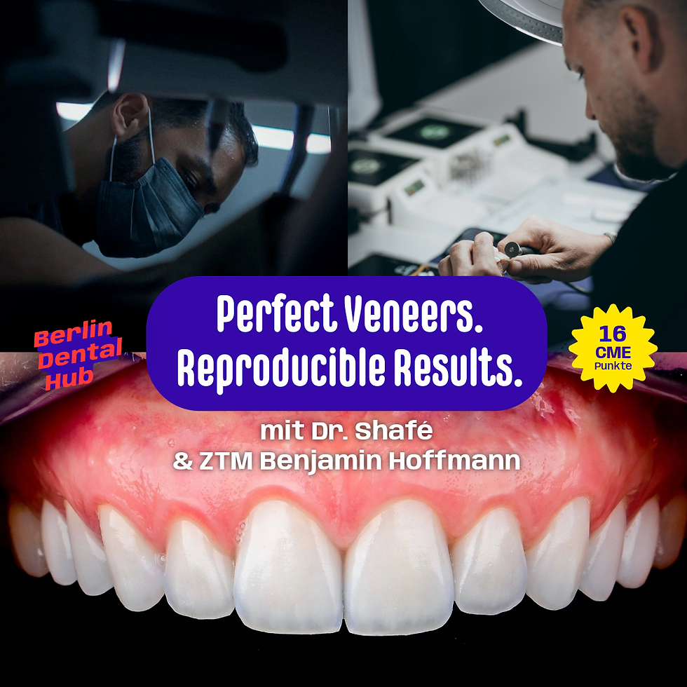 Perfect Veneers. Reproducible Results.
