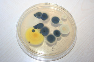 Kauf Einer Gebrauchten Immobilie Schimmel Im Haus