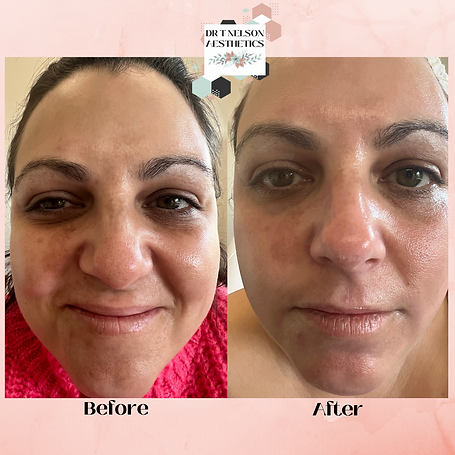 Before and afters.png