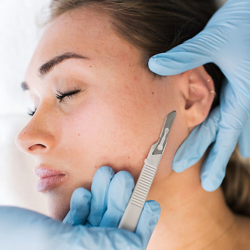 dermaplaning-cleveland.jpeg