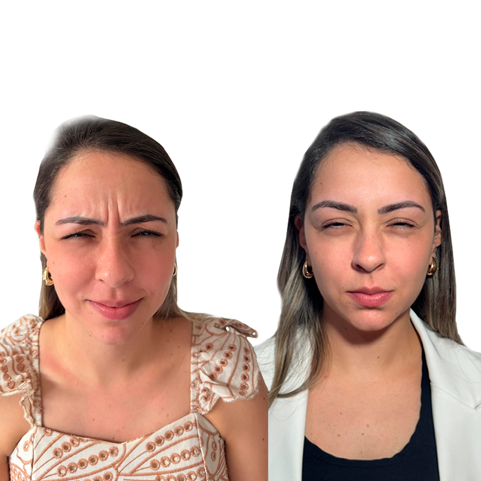 Botox 1