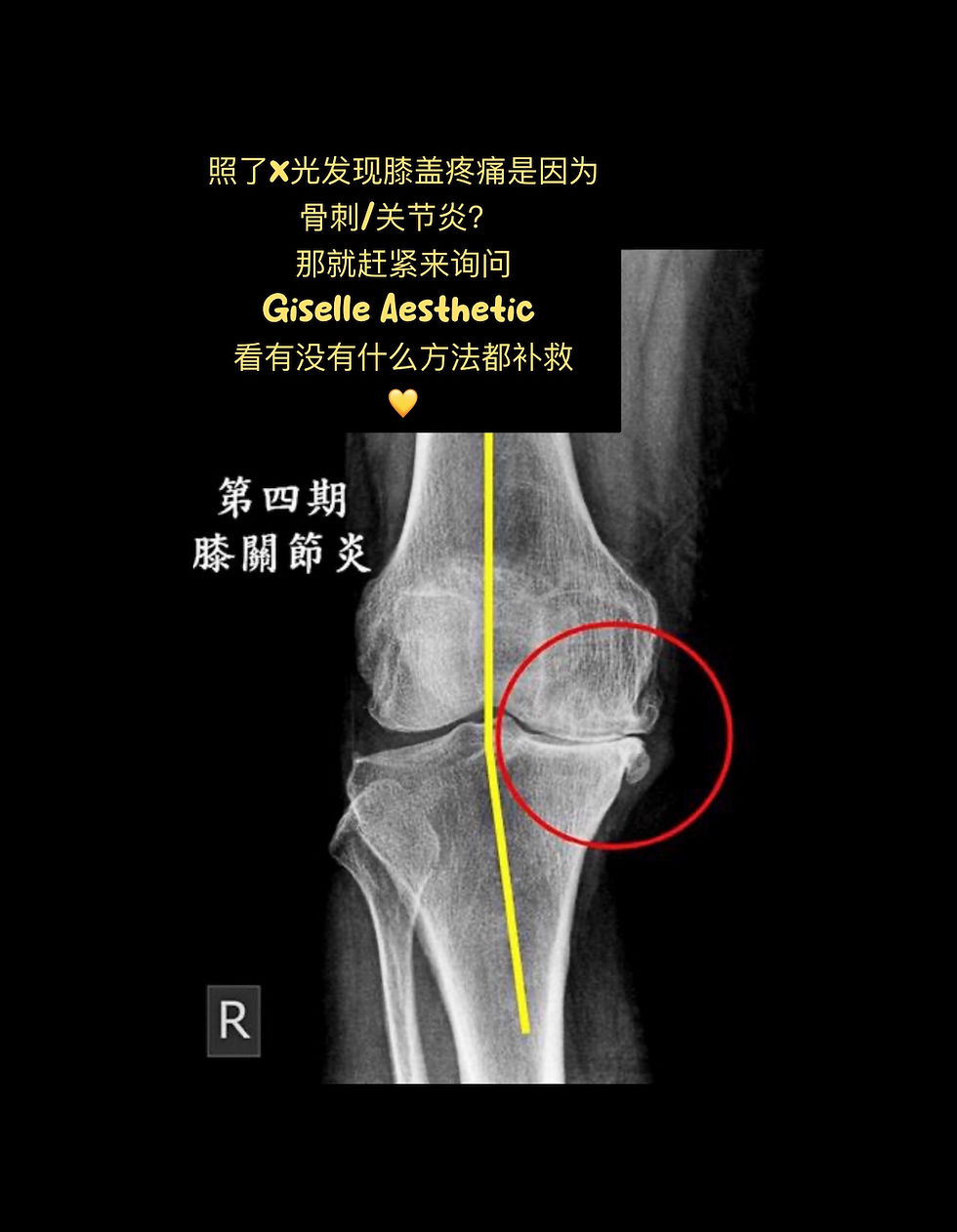 Thumbnail: PRP 血清疗法