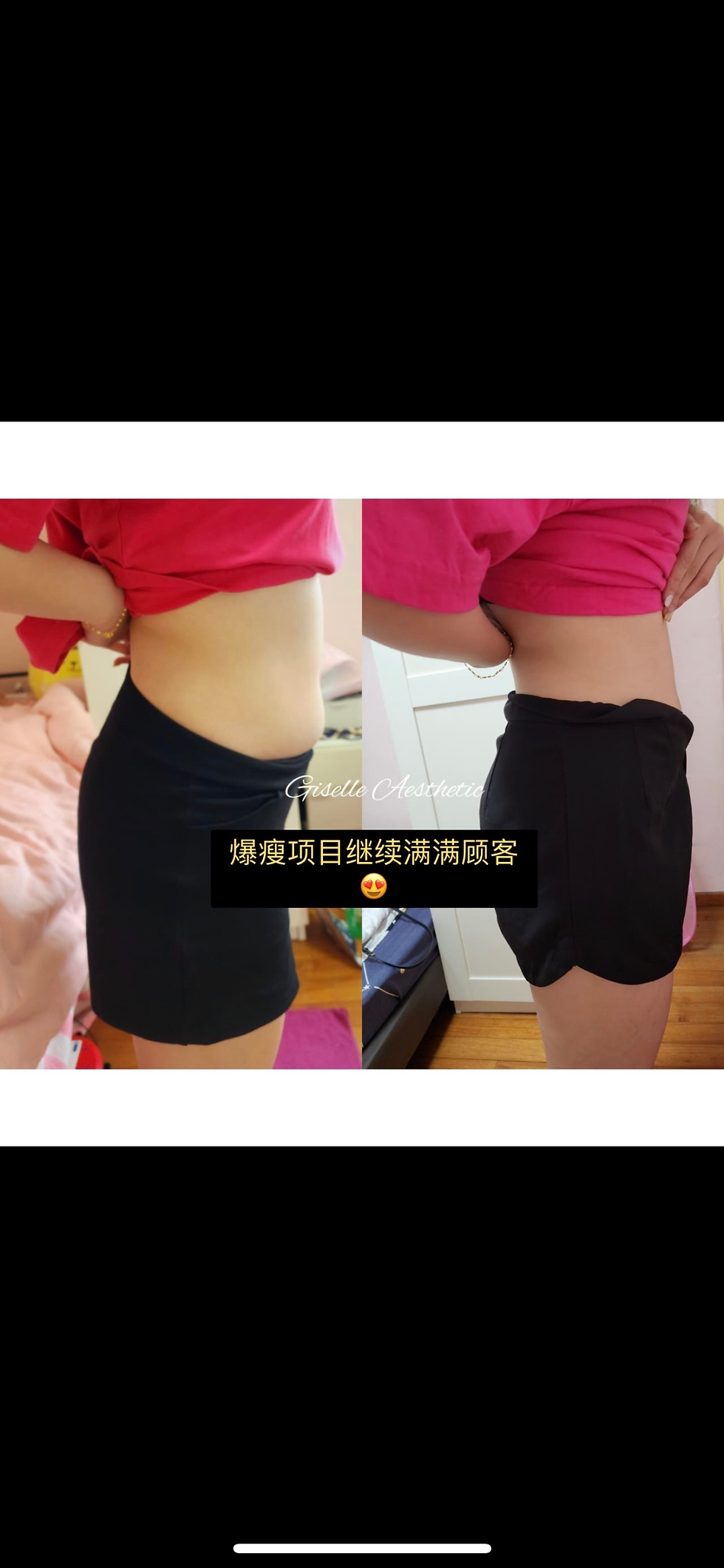 Thumbnail: 爆瘦针