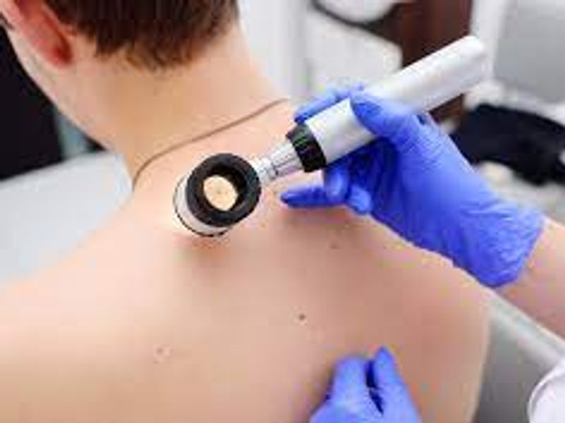 Dermatoscopia: Entendendo e Cuidando da Sua Pele
