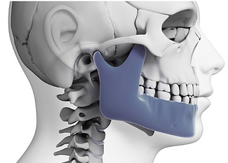 Traitements orthodontico-chirurgicaux | Dr Elise Pastwa | Orthodontie Saint-Étienne - Villars