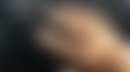 After 1 Session With BioSyntony