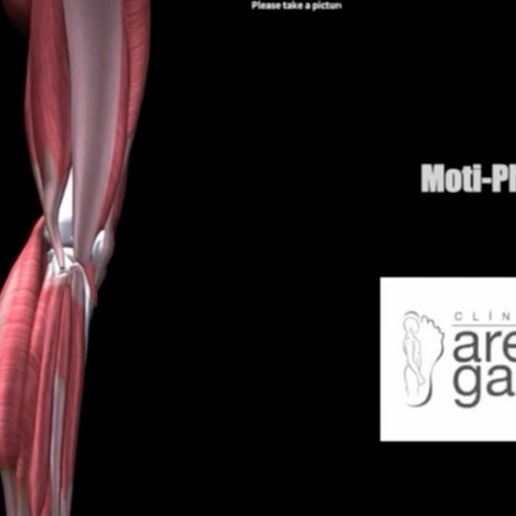 La Revolución de la Inteligencia Artificial, Sistema Moti Physio 