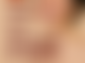 Akne Herbst Pflege Tipps