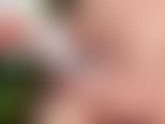 5 Doenças oculares relacionadas ao tabagismo