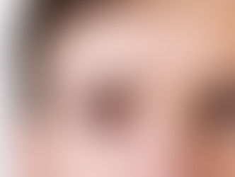 Toda conjuntivite é contagiosa?