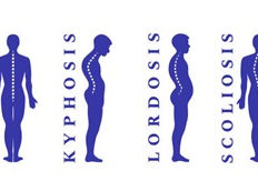 Spinal Asymmetries Consulting