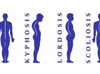 Spinal Asymmetries Consulting