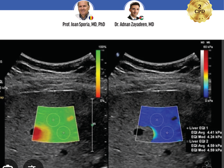 Liver Elastography Hands-On Ultrasound Workshop – Registration Open