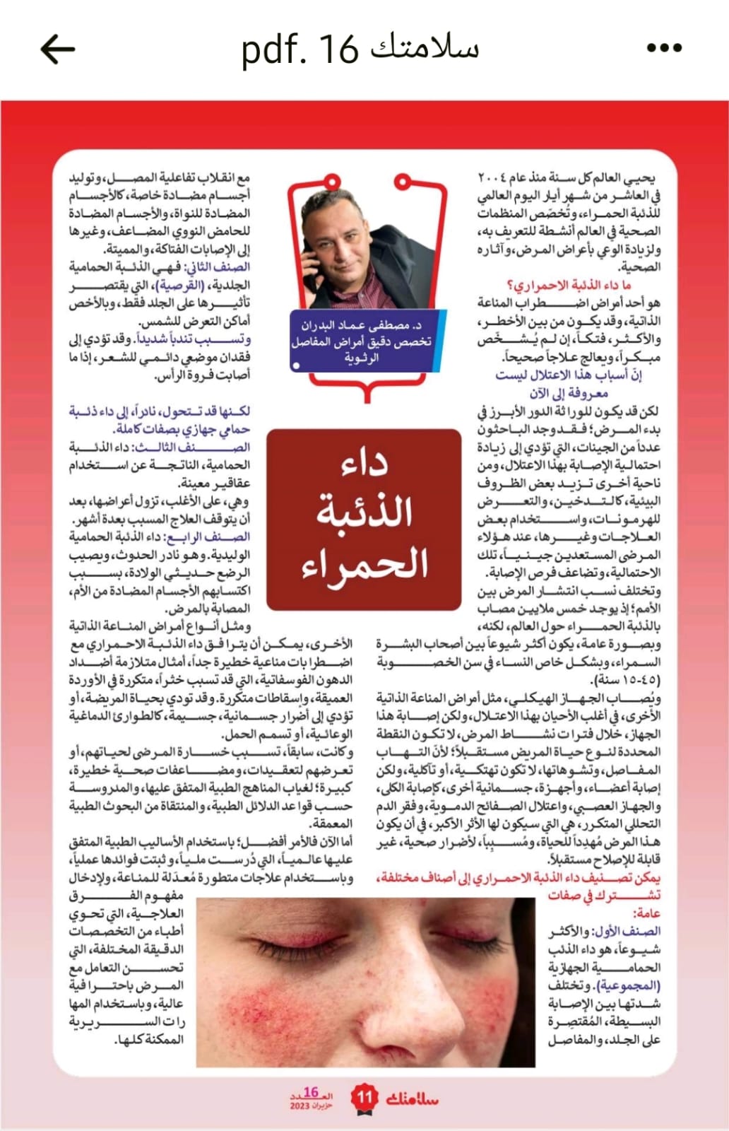 An awareness article directed to patients about systemic lupus erythematosus