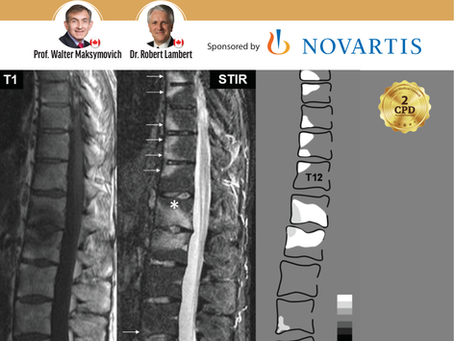 Axial Spondylopathy Workshop – Registration Open