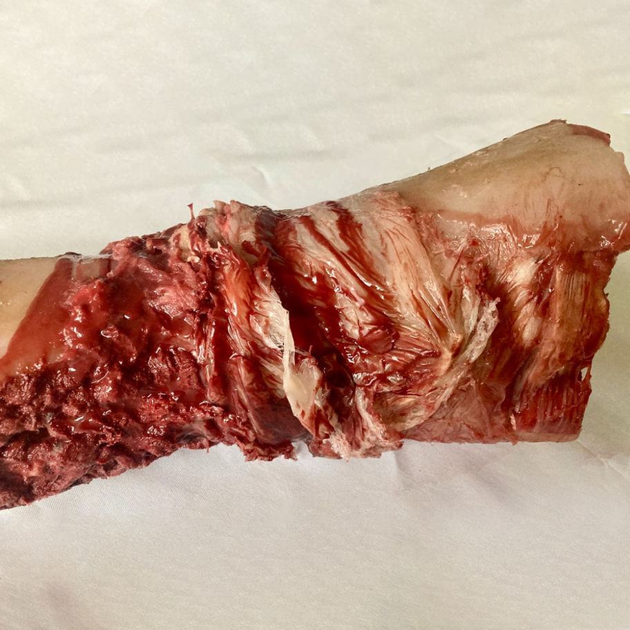 Simulated arm with deep laceration