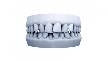 Proligner Crowded Case