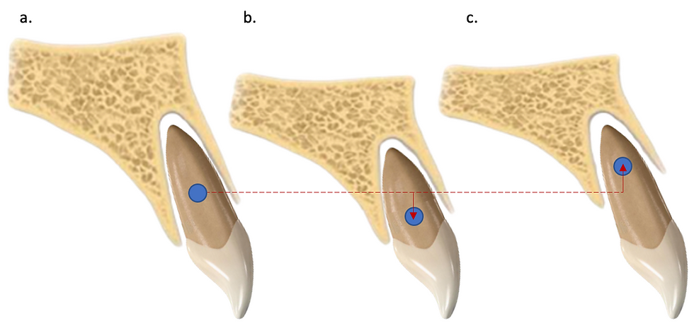 Biomechanics in Orthodontics - Root structures and supporting tissues - Centre of Rotation