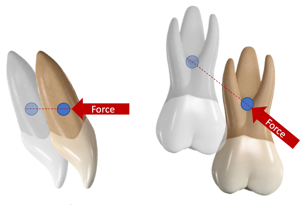 Biomechanics in orthodontics centre of resistance