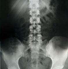 Do I Need An MRI To Treat My Back Pain?