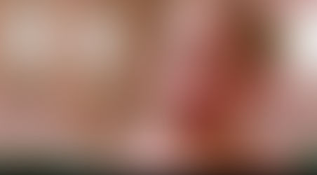 Adenoids: Can they be treated without surgery?