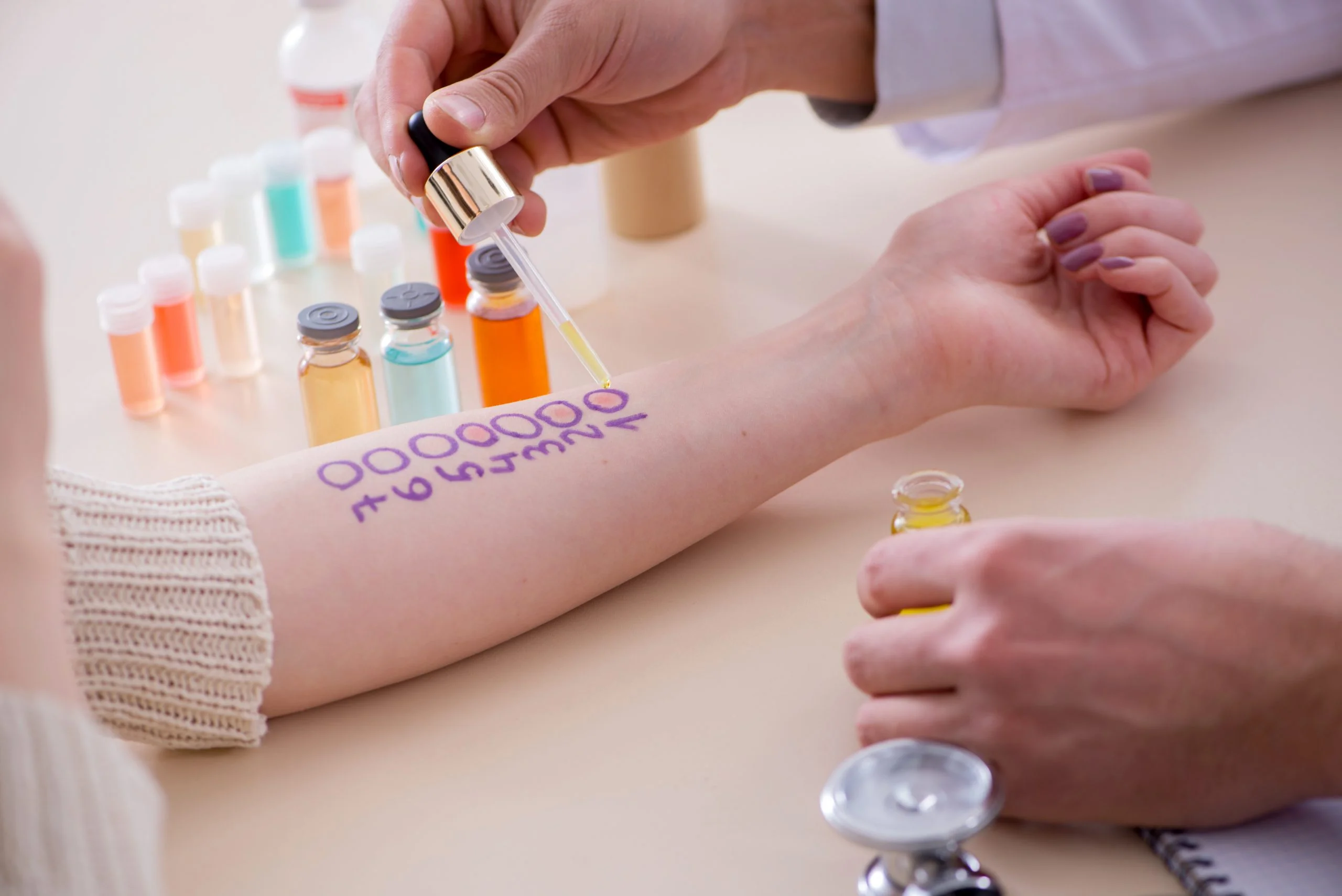 skin prick test