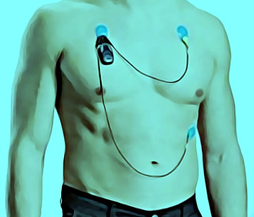 Holter Monitor
