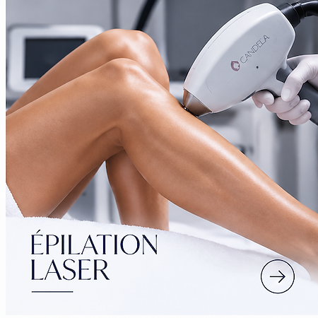 Epilation laser