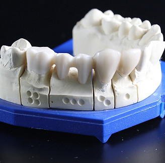 tooth-replacement-759928_1920.jpg