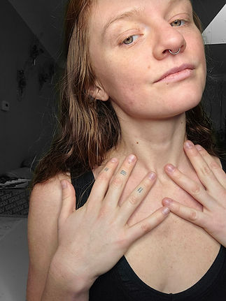 understanding the lymphatic system photo.jpg