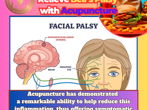 How to Naturally Relieve Bell’s Palsy with Acupuncture: A Guide to Caulo Care in Queens, New York