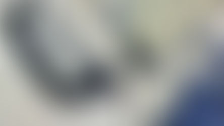 Μπορεί η υγεία των δοντιών να προστατεύσει από μία αυτοάνοση νόσο; 